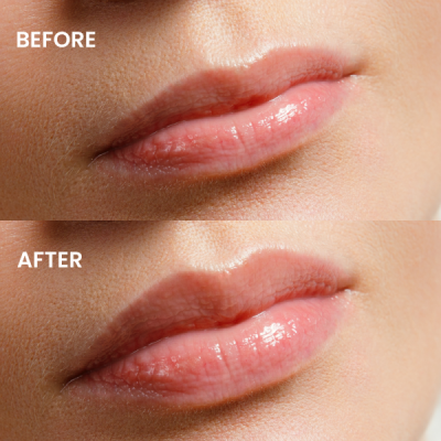 Mia Plumping lip gloss - 08 Disco Peach